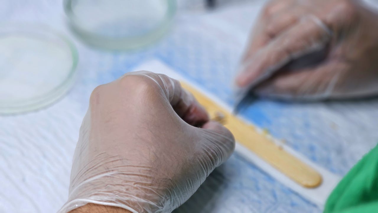 Detailed view of hair graft preparation during a hair transplant surgery.
